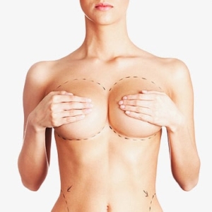 Breast Plastic Surgery